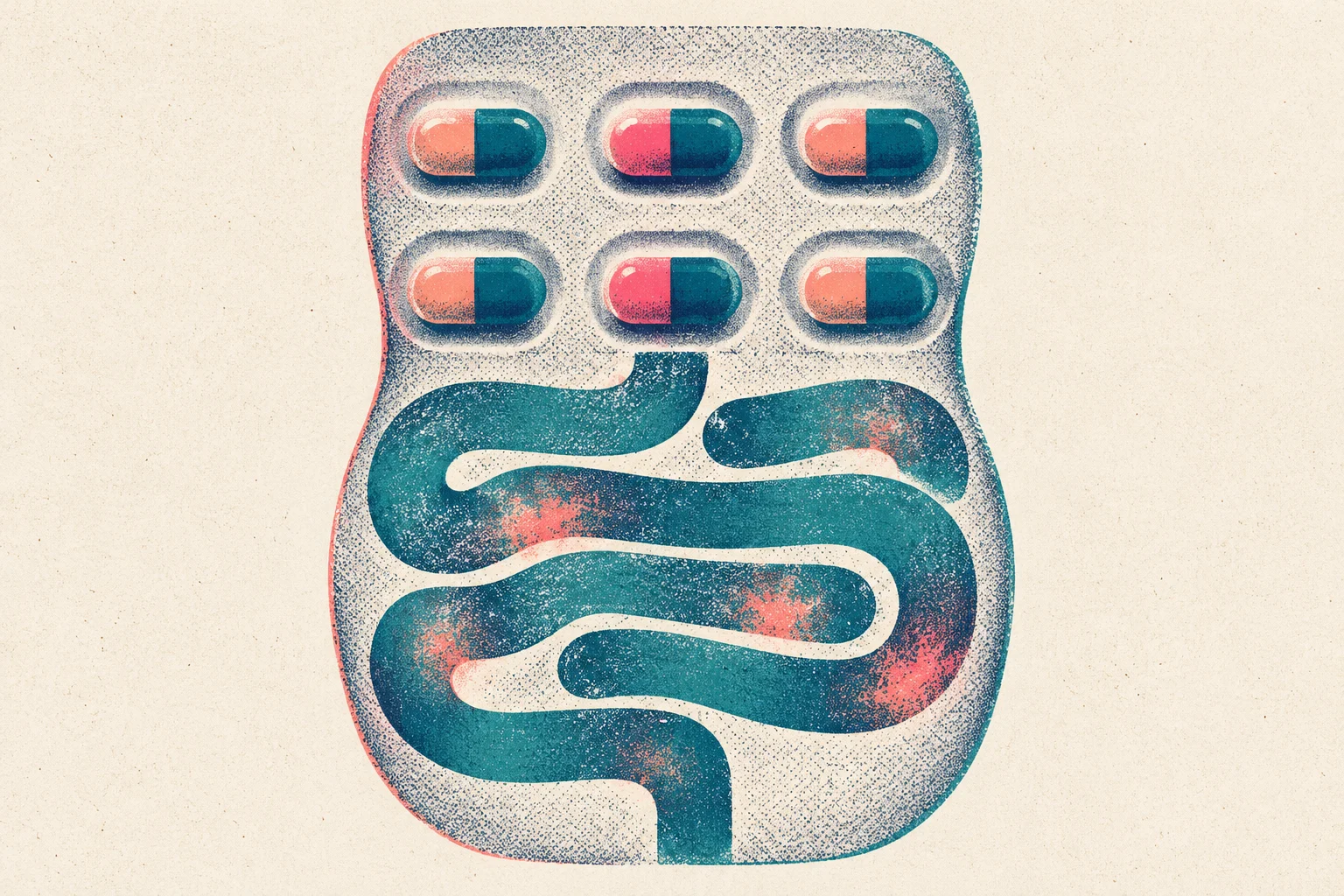 A textured illustration combines a blister pack of six coral and teal capsules with winding teal intestines dotted with coral patches on a cream background.